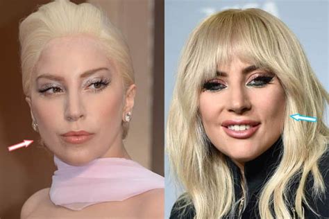 did lady gaga have plastic surgery why people care about it